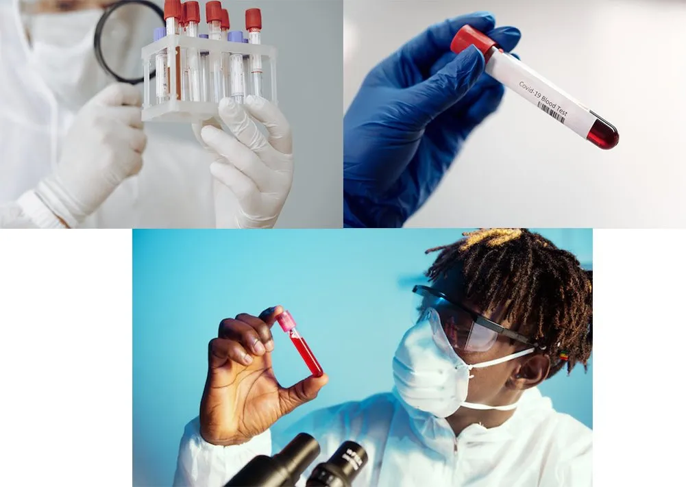 application of blood test collection tube